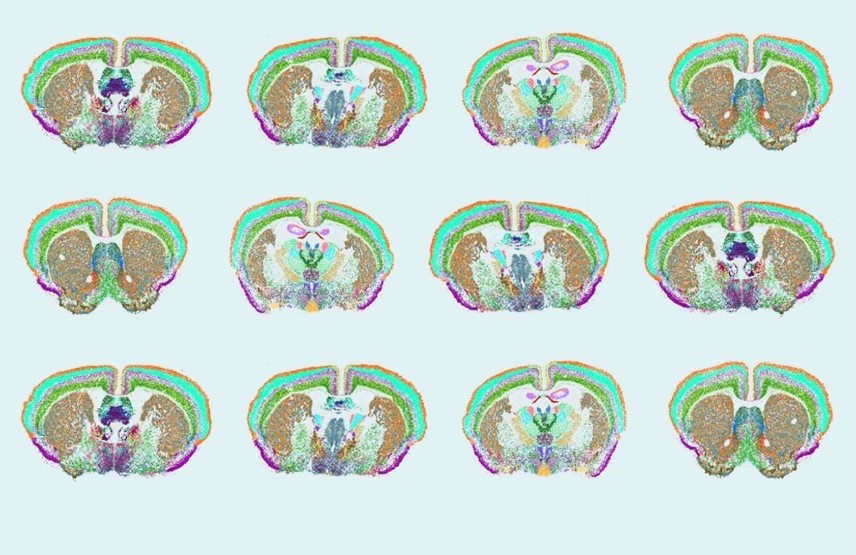 Image compilation showing scans of many mouse brains