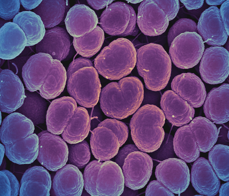 Scanning electron micrograph of Neisseria gonorrhoeae bacteria, which causes gonorrhea. Captured by the Research Technologies Branch (RTB) at the NIAID Rocky Mountain Laboratories (RML) in Hamilton, Montana. Scanning electron micrograph of Neisseria gonorrhoeae bacteria, which causes gonorrhea. Captured by the Research Technologies Branch (RTB) at the NIAID Rocky Mountain Laboratories (RML) in Hamilton, Montana.