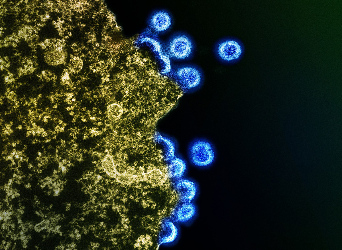 Transmission electron micrograph of HIV-1 virus particles (blue) replicating from the plasma membrane of an H9 T cell (yellow). 