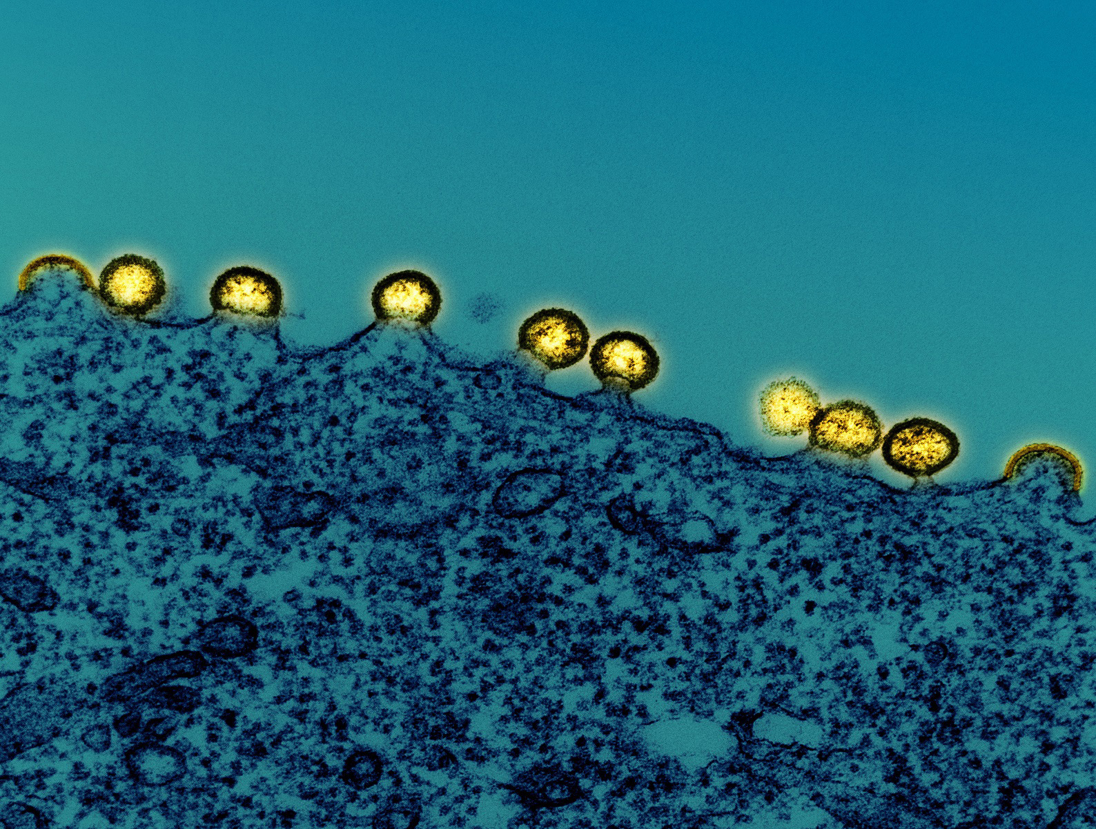 Microscope image of HIV particles replicating from an H9 T cell.