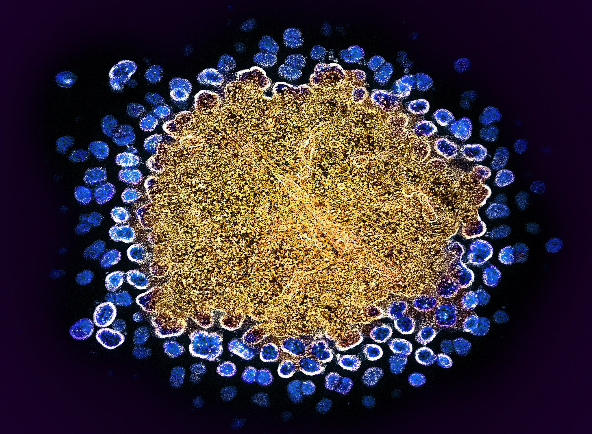 HIV-1 Virus Particles Replicating HIV-1 Virus Particles Replicating