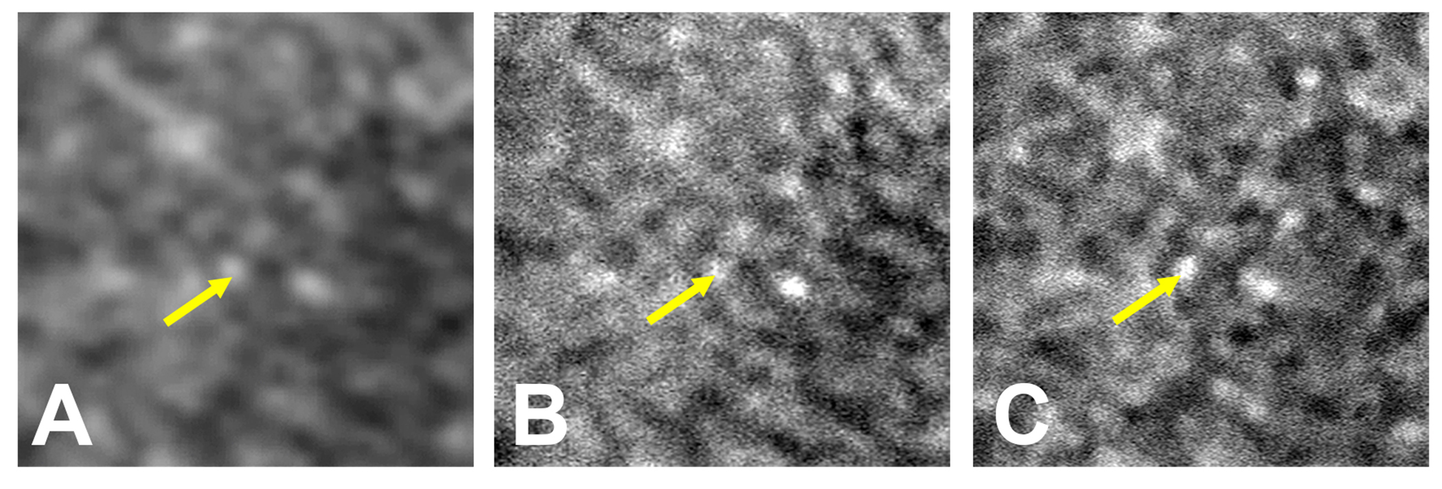 3 slides of retina tissue taken using three separate imaging techniques. Each image gets progressively clearer.