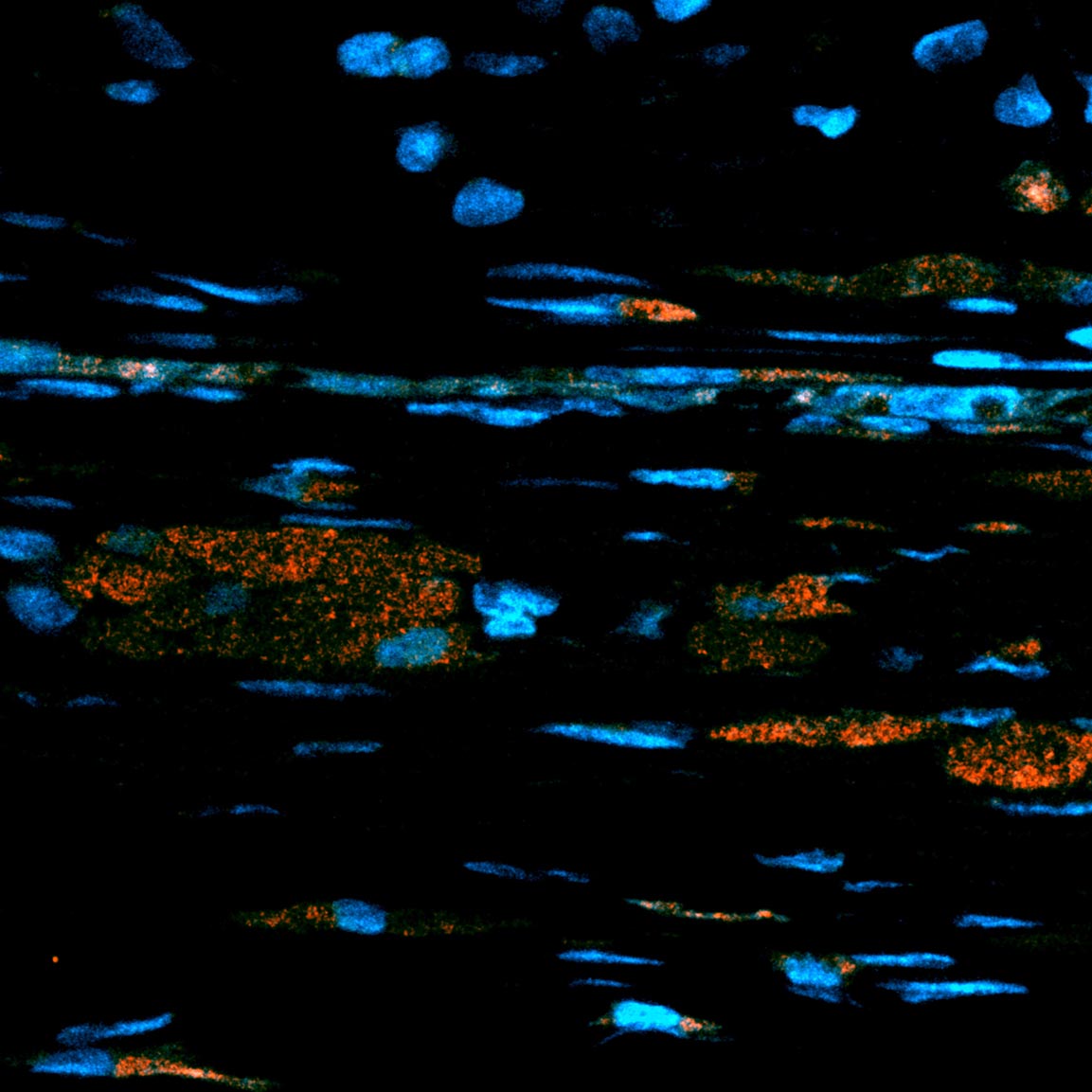 NIH scientists test in an animal model a surgical technique to improve cell therapy for dry AMD