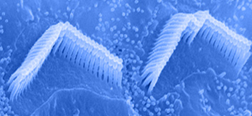 Tubular stereocilia on hair cell surface arranged in three rows of increasing heigh