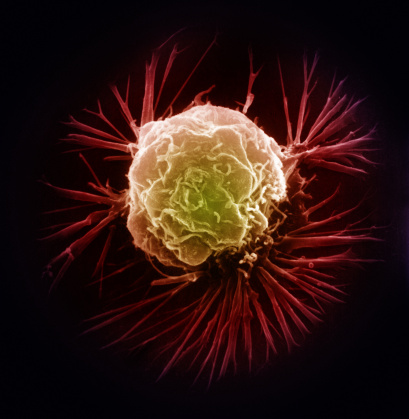 Three-dimensional image of lumpy round cell with multiple extensions