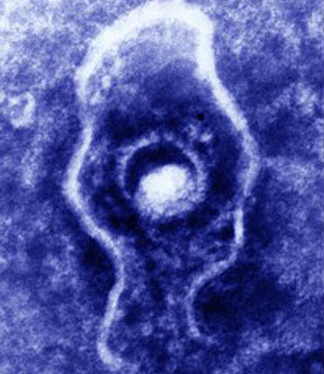 herpes zoster virus microscope