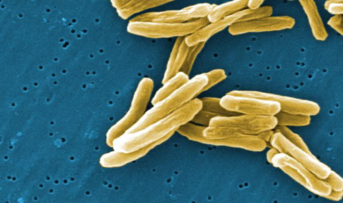 Electron micrograph of tuberculosis bacteria