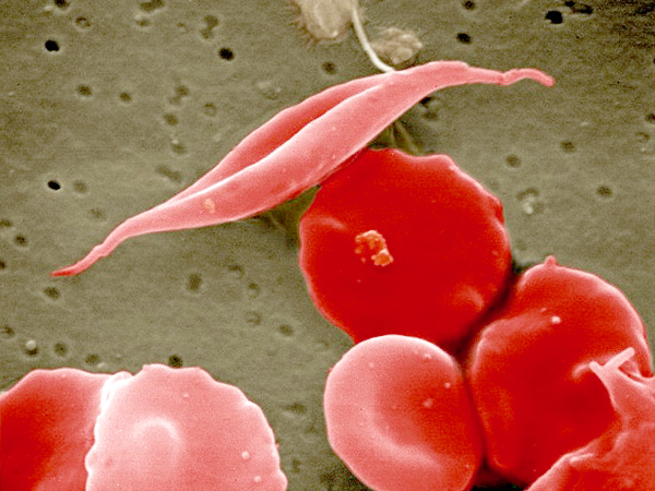 Scanning electron micrograph showing long cell at center among more disc-shaped cells