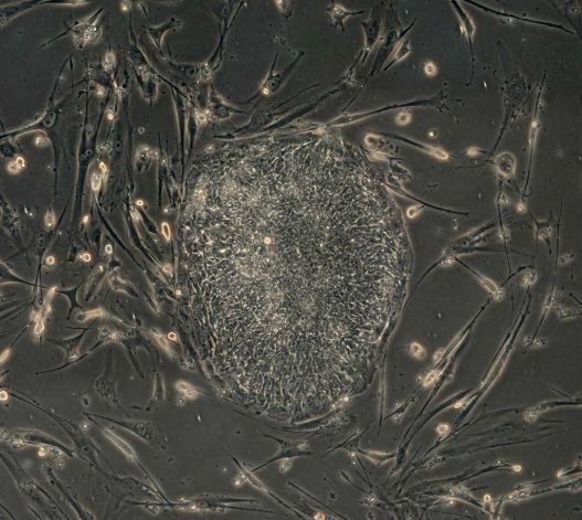 Cluster of long, thin cells around a central mass Cluster of long, thin cells around a central mass