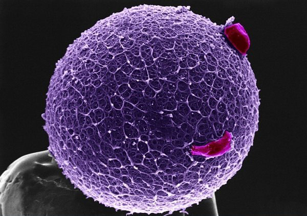 Scanning electron micrograph of a human egg Scanning electron micrograph of a human egg