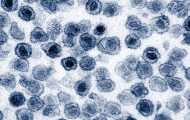 Transmission electron micrograph of round virus particles Transmission electron micrograph of round virus particles