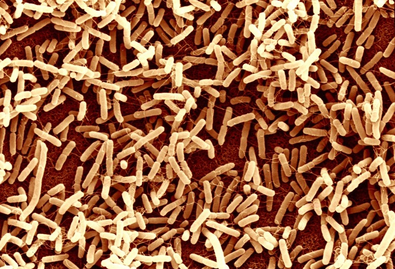 Electron micrograph of rod-shaped bacteria