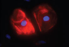 Image of enlarged heart cells with organized red fibers Image of enlarged heart cells with organized red fibers