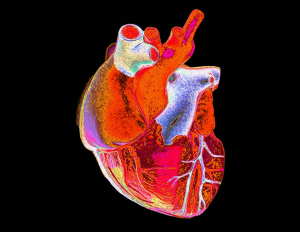 Digitally enhanced photograph of a human heart