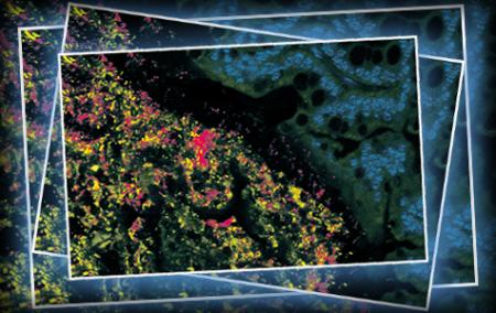 Microscope image of microbes on intestine surface Microscope image of microbes on intestine surface