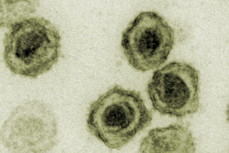 Transmission electron micrograph of round virus particles