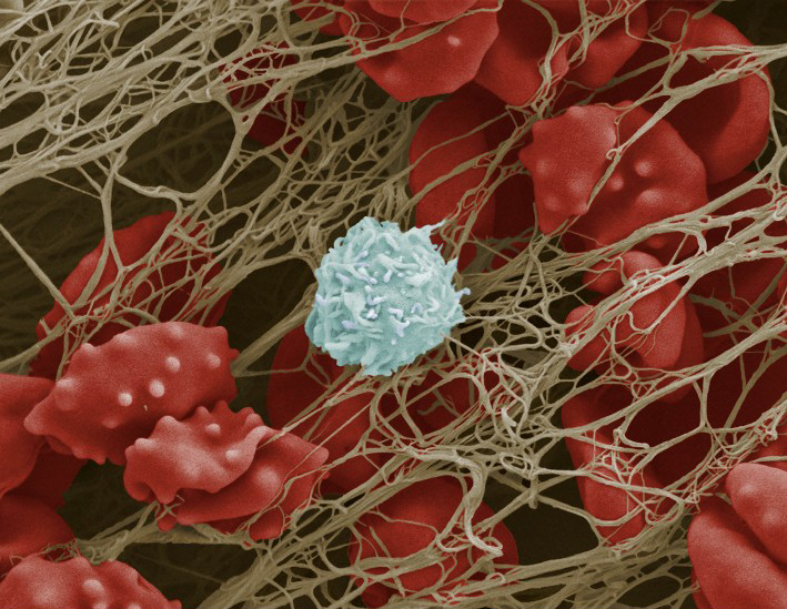Scanning electron micrograph of blood cells trapped in a fibrous mesh Scanning electron micrograph of blood cells trapped in a fibrous mesh