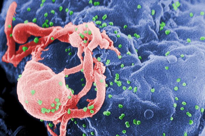 Scanning electron micrograph of HIV-1 virions budding from a cultured lymphocyte.