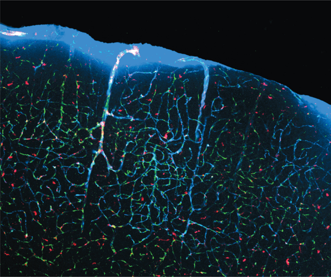 Fluid flowing through channels in the brain.