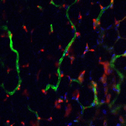 Human blood vessels.