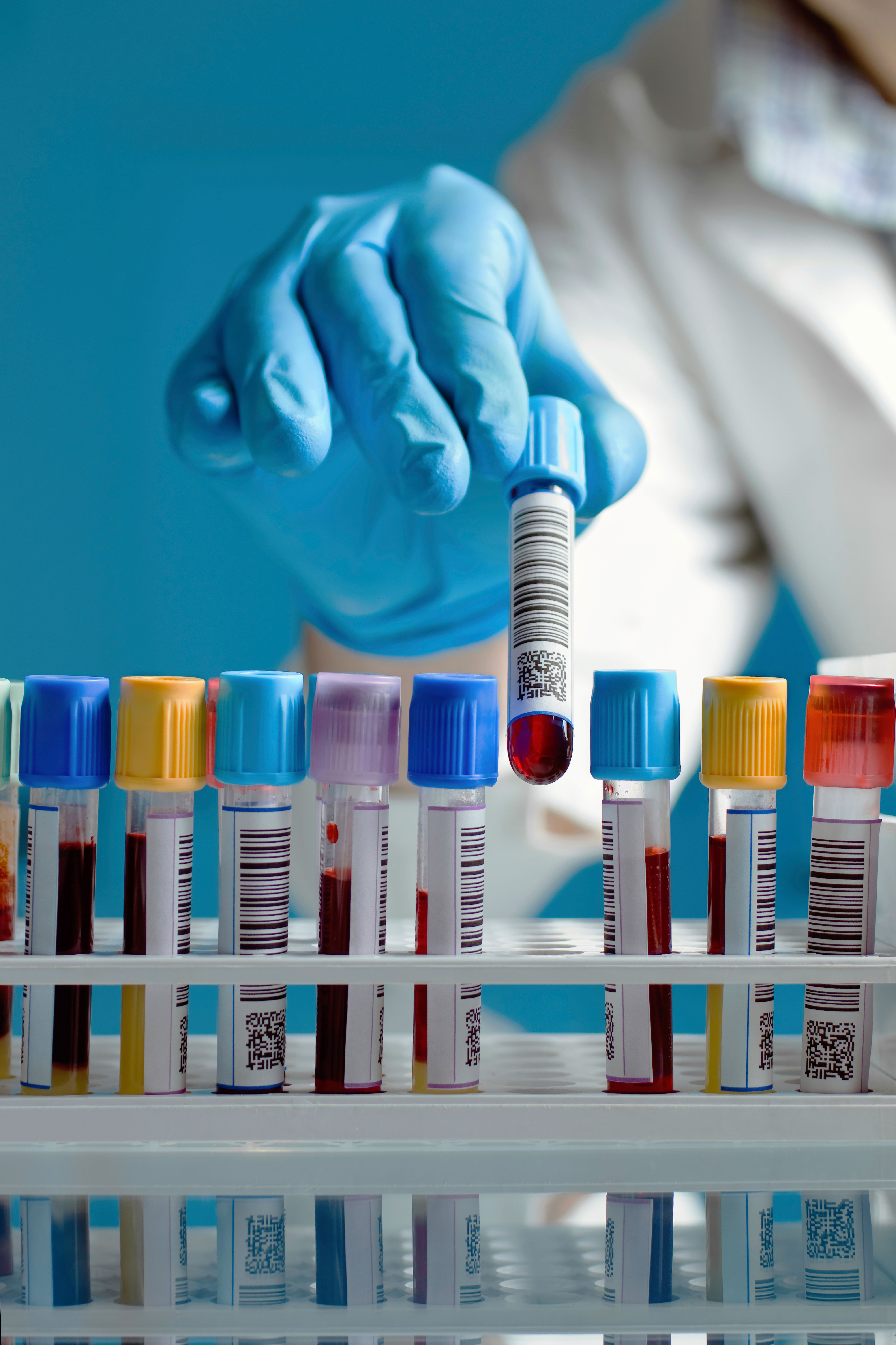 Scientist taking a blood sample tube from a rack.