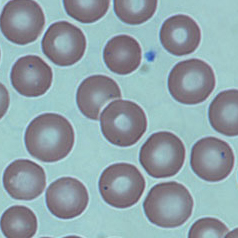 Torus-shaped cells Torus-shaped cells.