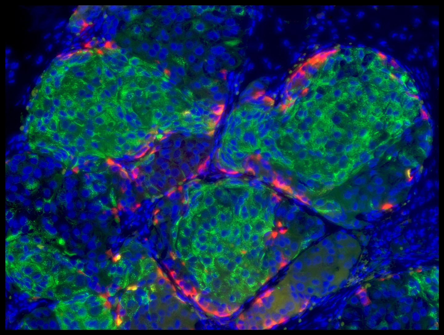Human stem cell-derived beta cells Human stem cell-derived beta cells.