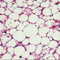 Image of fat cells taken through a microscope.