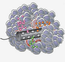 Illustration of cylindrical device inside a tumor Illustration of cylindrical device inside a tumor.