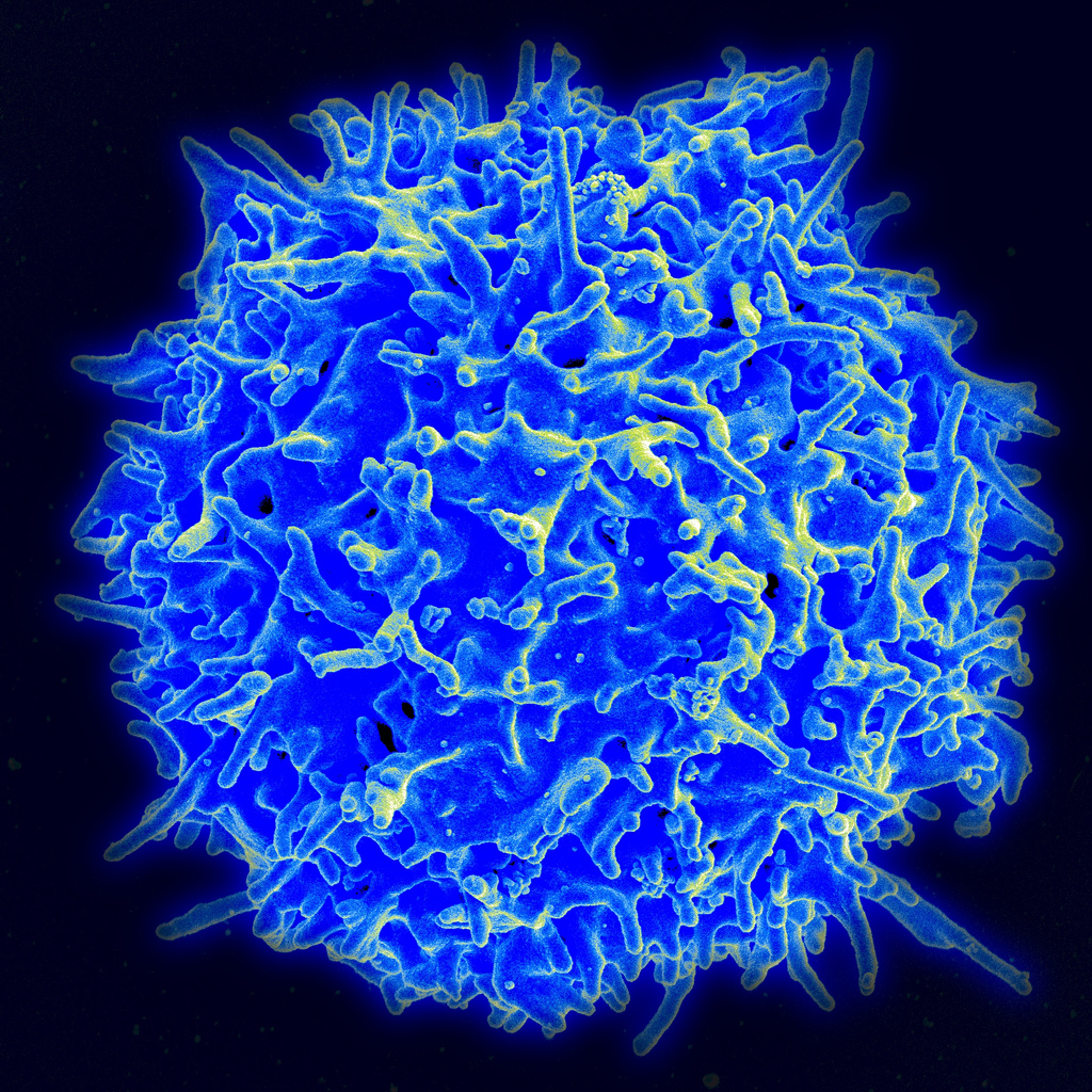 Autoimmune Disease Super-Regulators Uncovered | National Institutes of Health (NIH) Autoimmune Disease Super-Regulators Uncovered | National Institutes of Health (NIH)