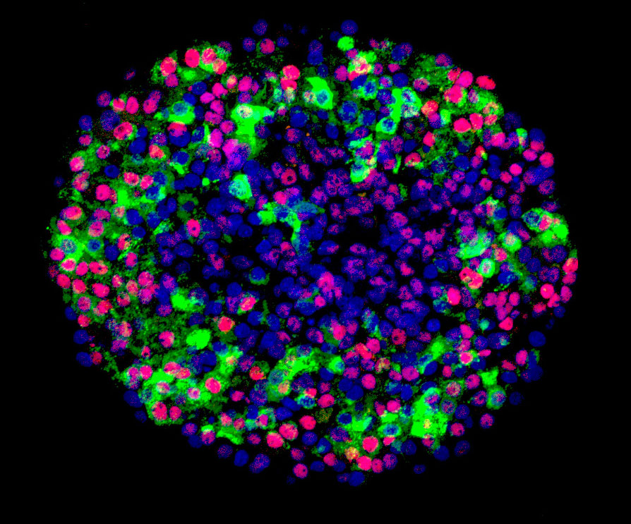 Encapsulated cells treat diabetes in mice | National Institutes of Health  (NIH)