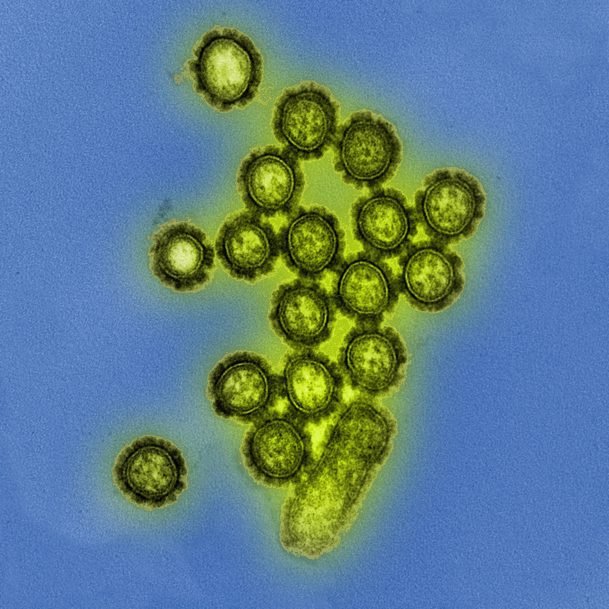 H1N1 Influenza Virus Particles Colorized electron micrograph of H1N1 influenza virus particles.