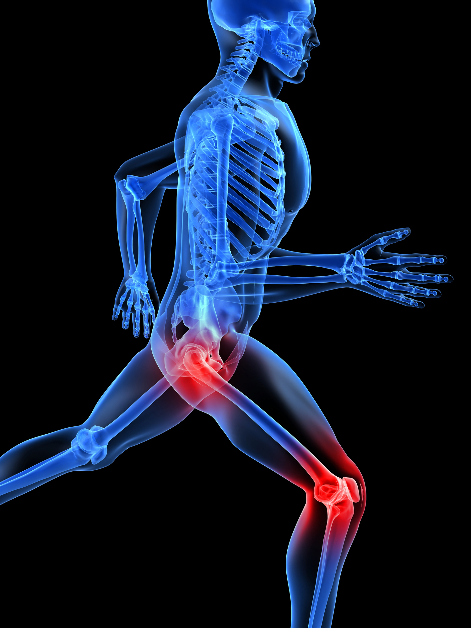 Illustration of human skeleton with hip and knee joints glowing red.