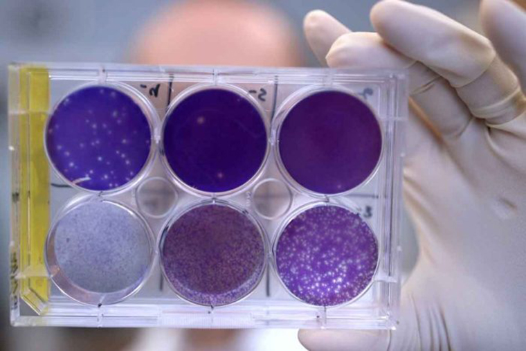 Researcher holding a tray of Zika virus growing in cells.