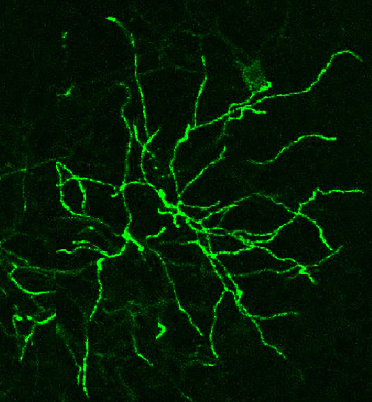 Confocal microscope image of neurons
