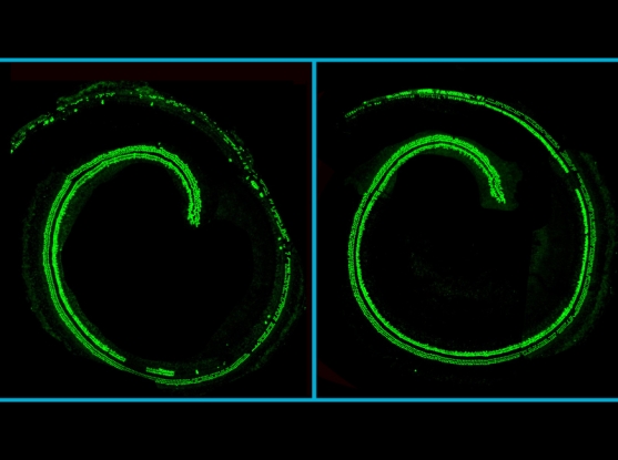 Confocal microscopy images of mouse cochlea.