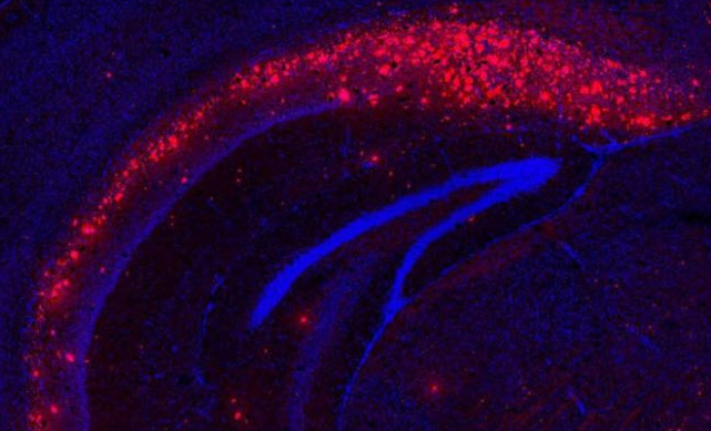 Amyloid-beta in mouse brain