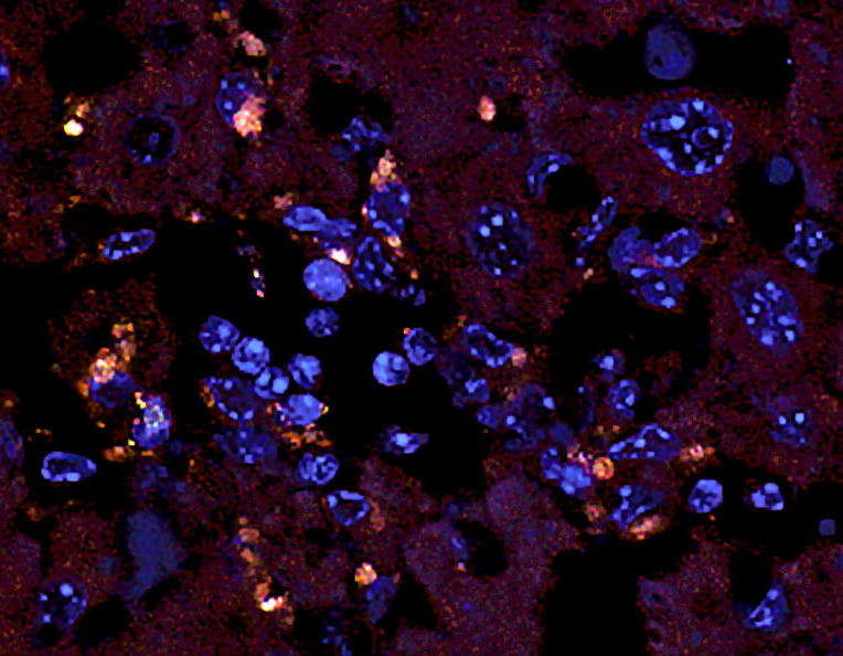 A microscopic image of liver tissue with bacteria A microscopic image of liver tissue with bacteria