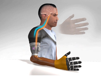 Illustration of man with prosthetic hand