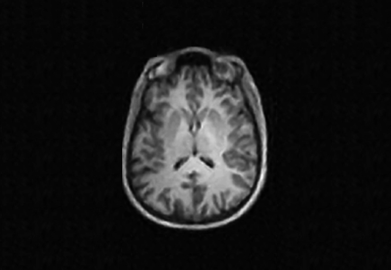 Brain images