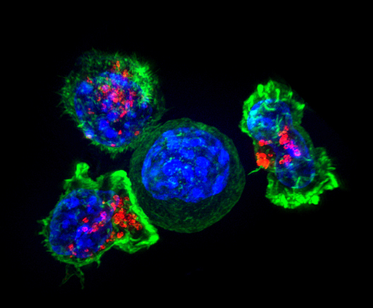 Killer T cells surrounding a cancer cell 