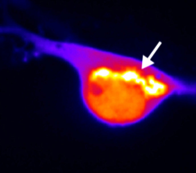 Micrograph of nerve cell