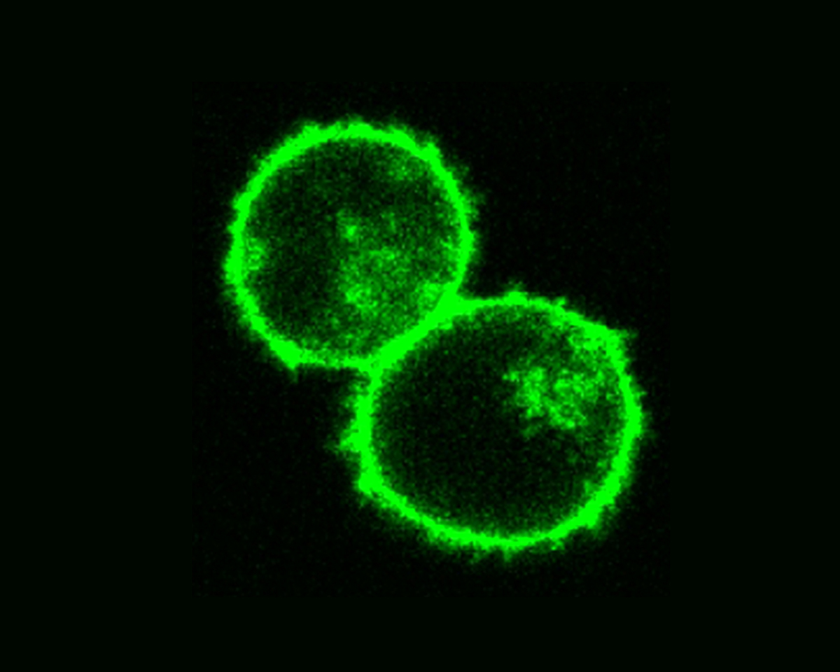 Two T cells that have been altered by using CRISPR and electroporation.