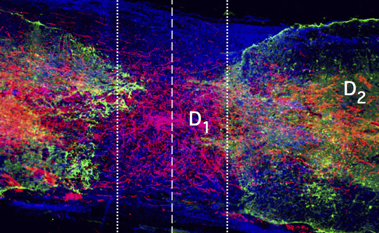 Microscope image of axons growing across a spinal cord injury Microscope image of axons growing across a spinal cord injury
