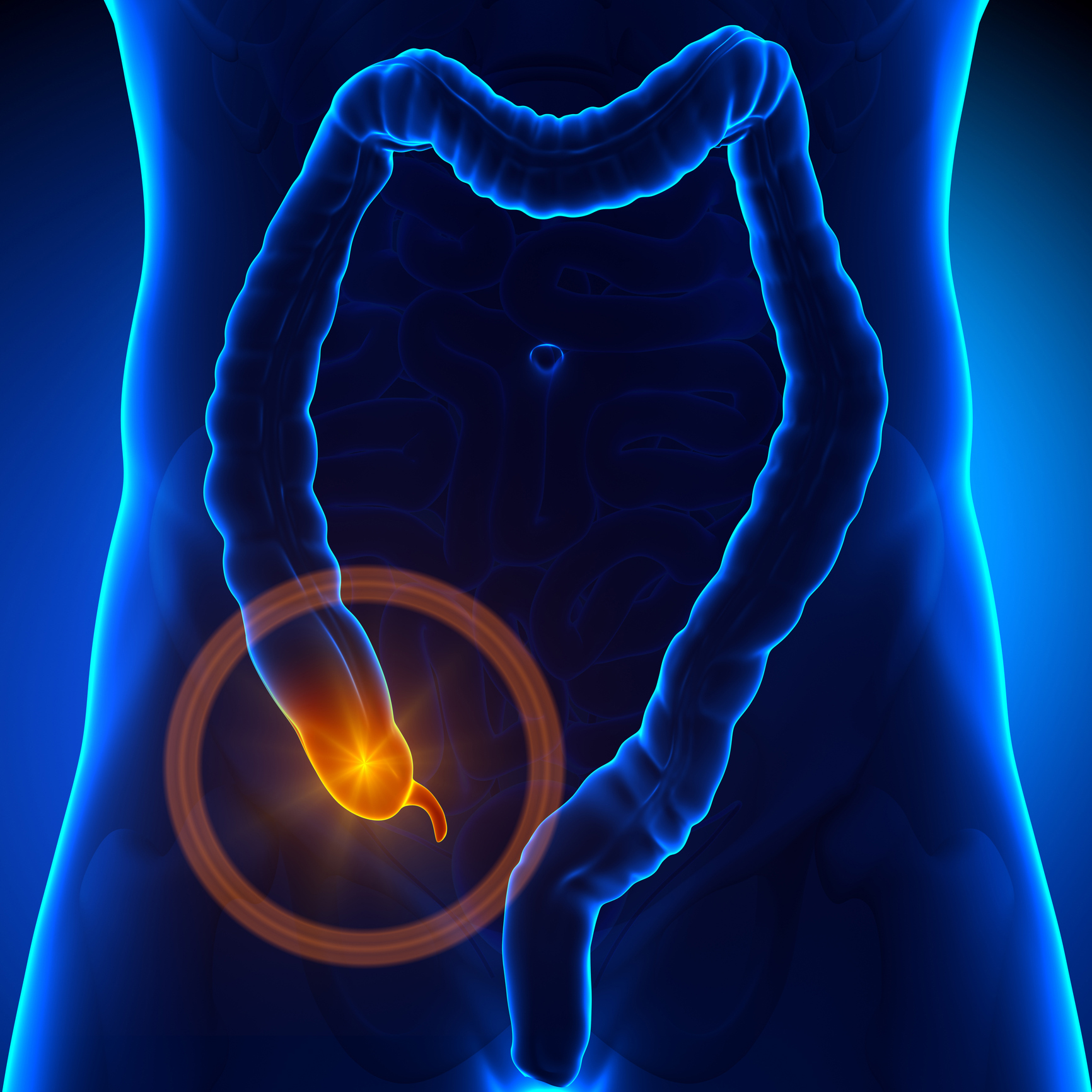 Illustration of the appendix