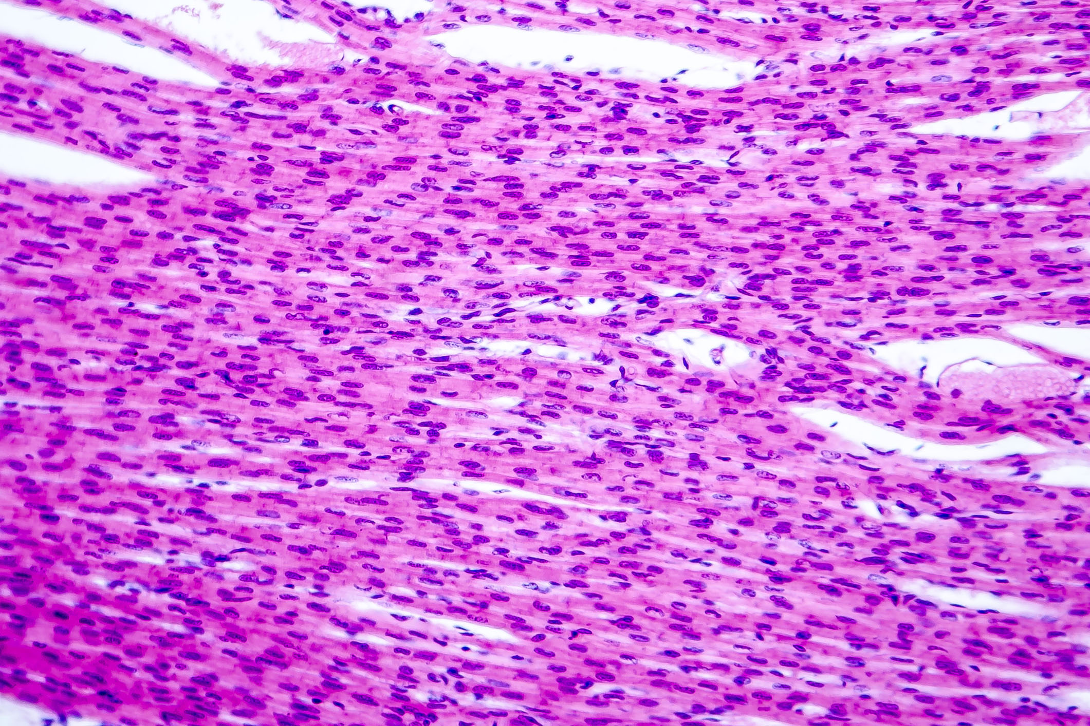 Histological image of heart muscle