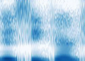 Speech spectrograms