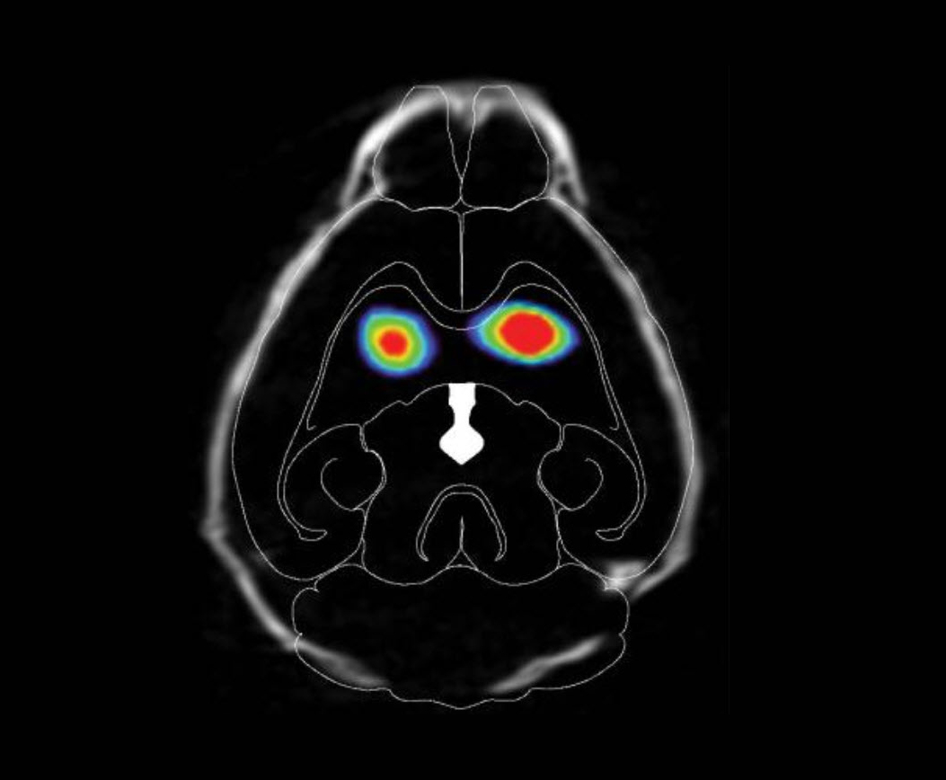 Dopamine transporter in mouse brain scans. Brains of mice injected with misfolded alpha-synuclein have less dopamine.