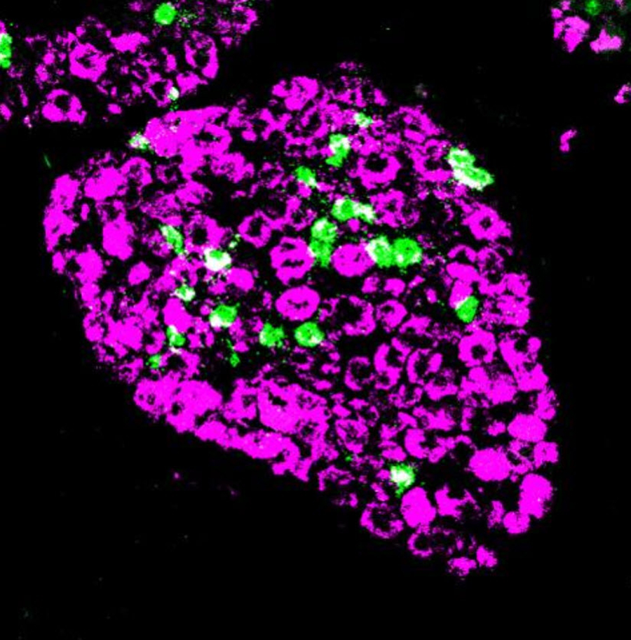 Nerves in a dorsal root ganglion Nerves labelled green scattered among magenta ones
