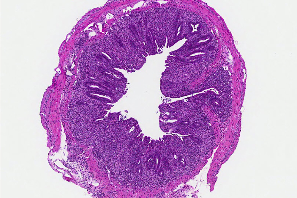 Section of mouse colon tissue